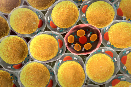 June29_2015_iStock_000047093550_FatCells_DepersonalizedMedicineCancer_GNH5834185230.jpg June29_2015_iStock_000047093550_FatCells_DepersonalizedMedicineCancer_GNH5834185230.jpg
