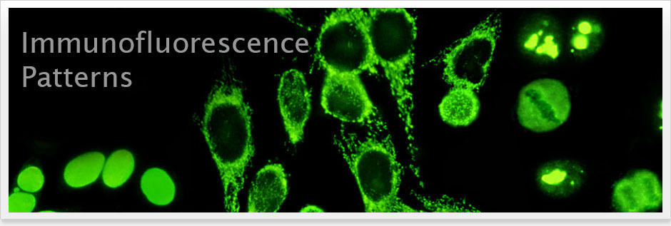 mien-dich-huynh-quang-Immunofluorescence.jpg
